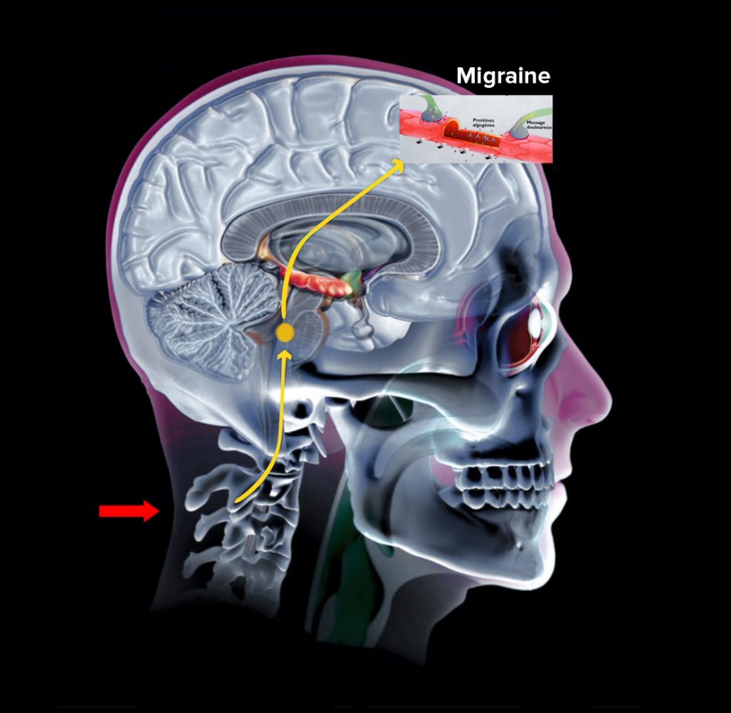 Neurologie